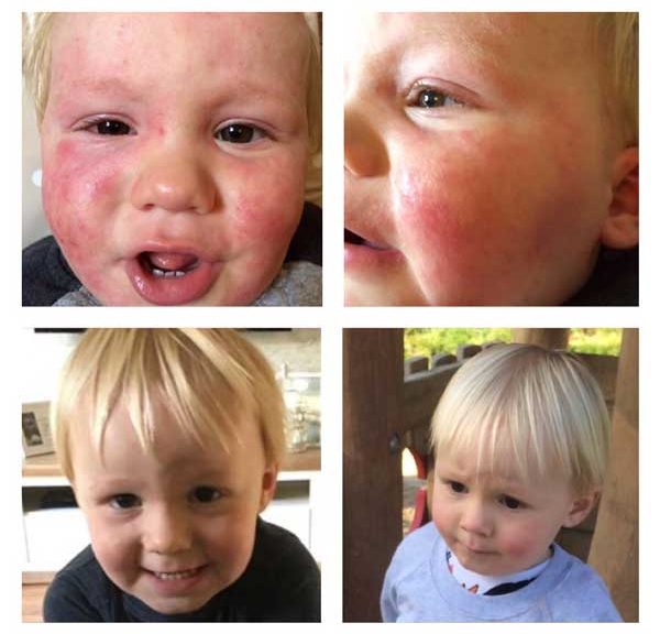 Allergy Testing Marlborough House Therapy Centre