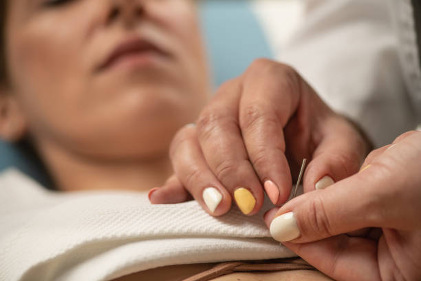 Acupuncture for Depression and Anxiety